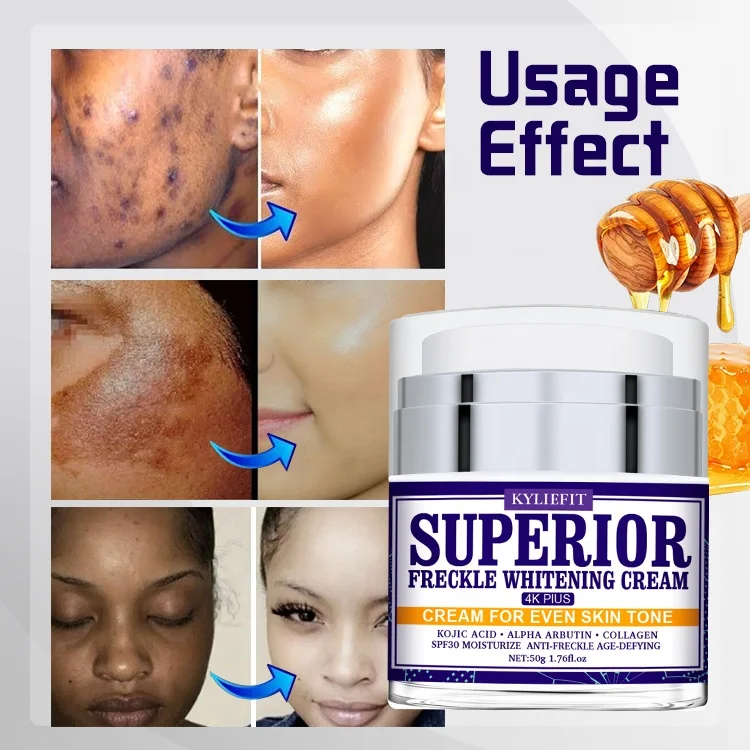 Own Brand Vitamin C Anti-aging and Wrinkles Anti Freckle Black Spots Whitening Face Cream in Saudi Arabia