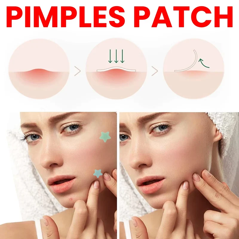 Salicylic Acid Unique Compact Oem Cute Invisible Private Label Custom Design Korean Hydrocolloid Acne Pimple Patches for Face