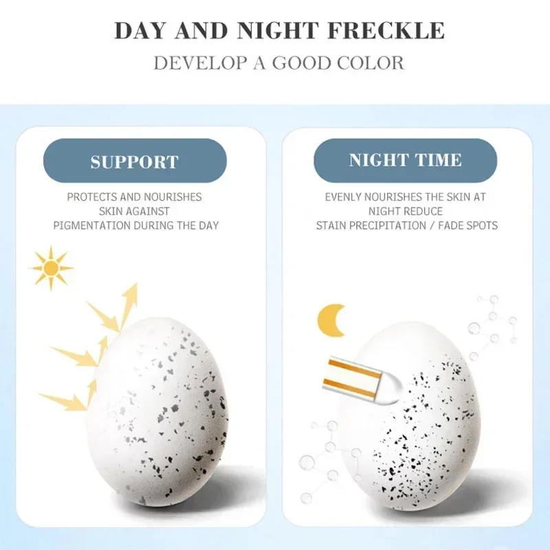Melasma Brightening Face Cream Niacinamide Serum Brighten Cream Fade Fine Lines Lighten Dark Dot Reduce Melanin Face Skincare