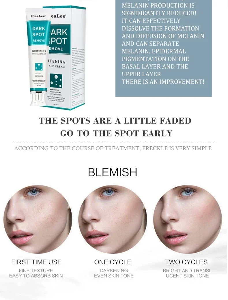 Melasma Brightening Face Cream Niacinamide Serum Brighten Cream Fade Fine Lines Lighten Dark Dot Reduce Melanin Face Skincare