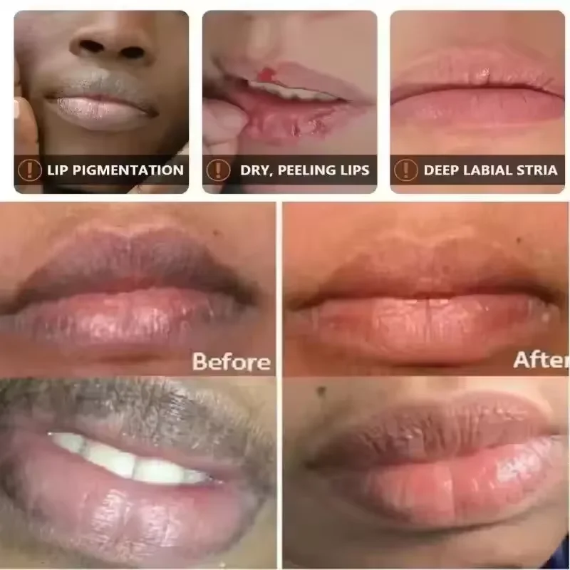 Remove Dark Lip Balm Serum Fast Lighten Melanin Lip Mask Exfoliating Fade Lip Lines Dead Skin Nourishing Repair Lip Care Makeup
