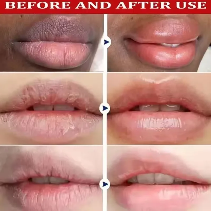 Remove Dark Lip Balm Serum Fast Lighten Melanin Lip Mask Exfoliating Fade Lip Lines Dead Skin Nourishing Repair Lip Care Makeup