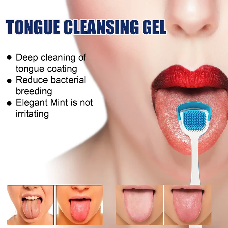 EELHOE Tongue Cleaning Gel with Brush Oral Care Removal Odor Health Fresh Breath Care Dental Hygiene Tools Coating Cleaning Kit