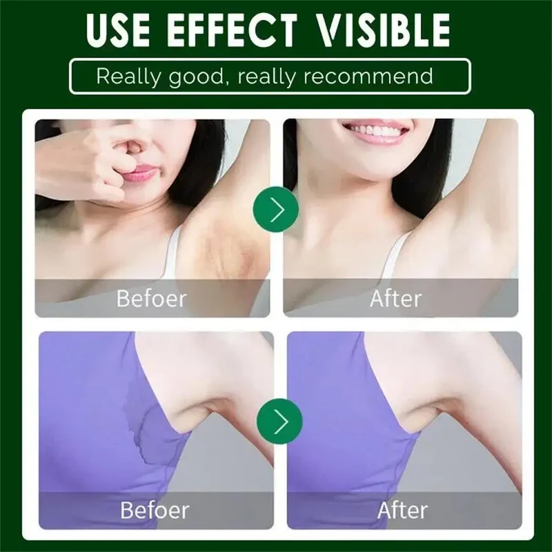 Body Odor Removal Antiperspirant Hair Inhibitor Long Lasting Effect Sweat Odor Deodorant Fresh Pleasant Rose Fragrance Body Care