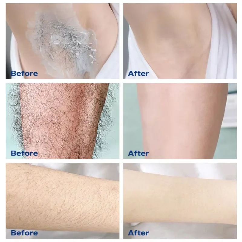 Sakura Hair Removal Cream Fast Painless Hair Growth Inhibitor Arm Armpit Legs Intimate Areas Permanent Depilatory for Men Woman