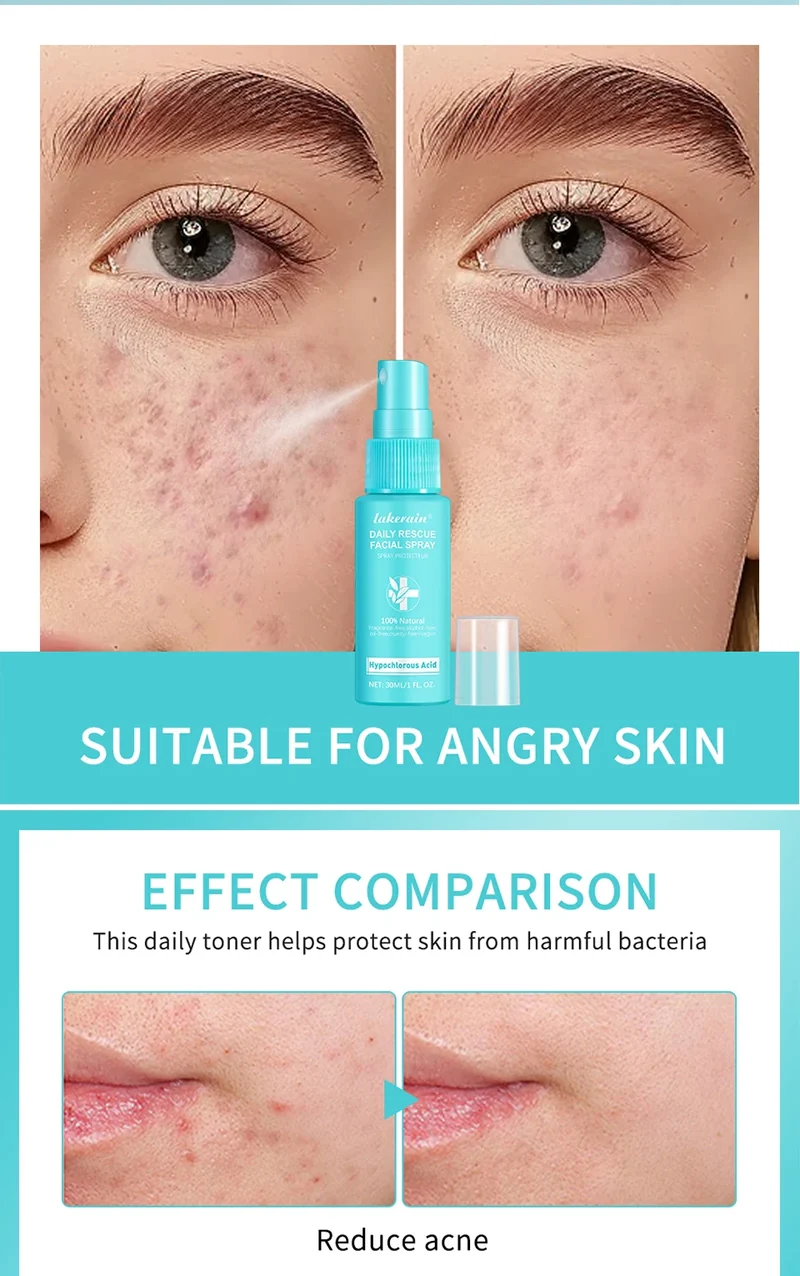 Hypochlorous Acid Spray Toner for Face Helps Reduce Redness Breakouts Soothing pH Balancing Toner Skincare