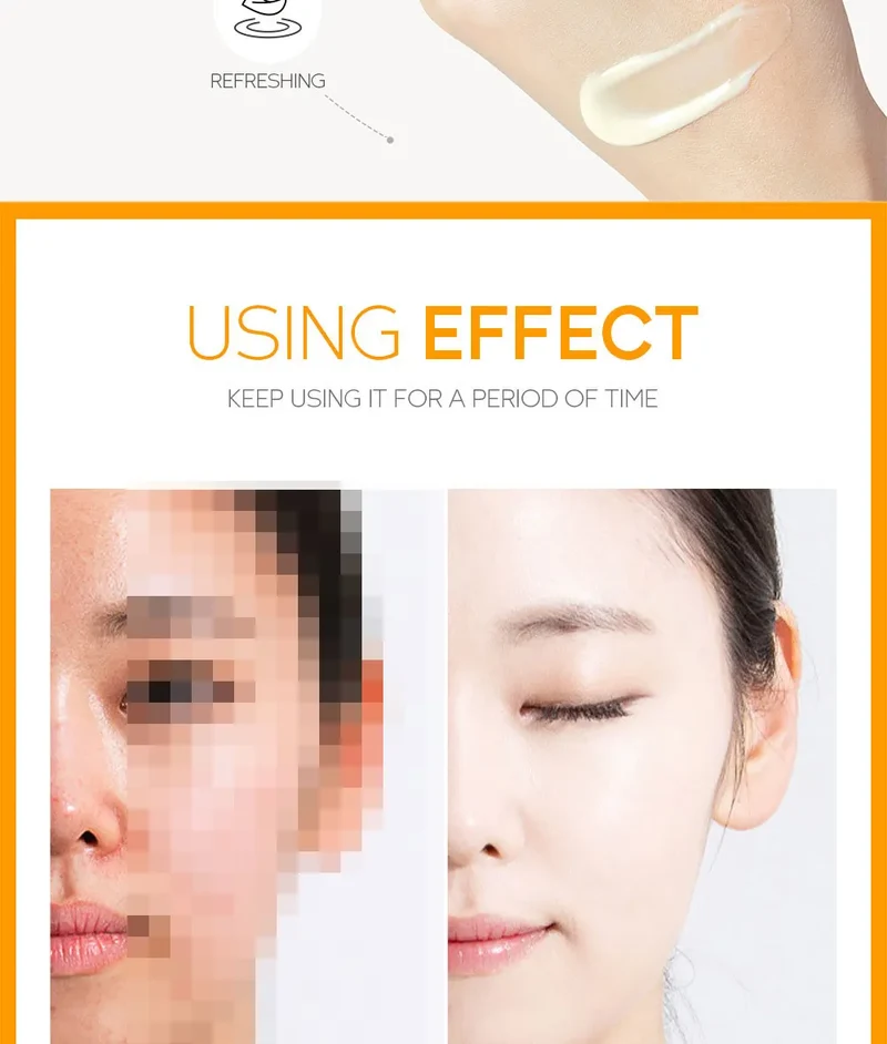 LAIKOU VITAMIN WHITENING CREAM Lightening Repairing Smooth Skincare Whitening Creams