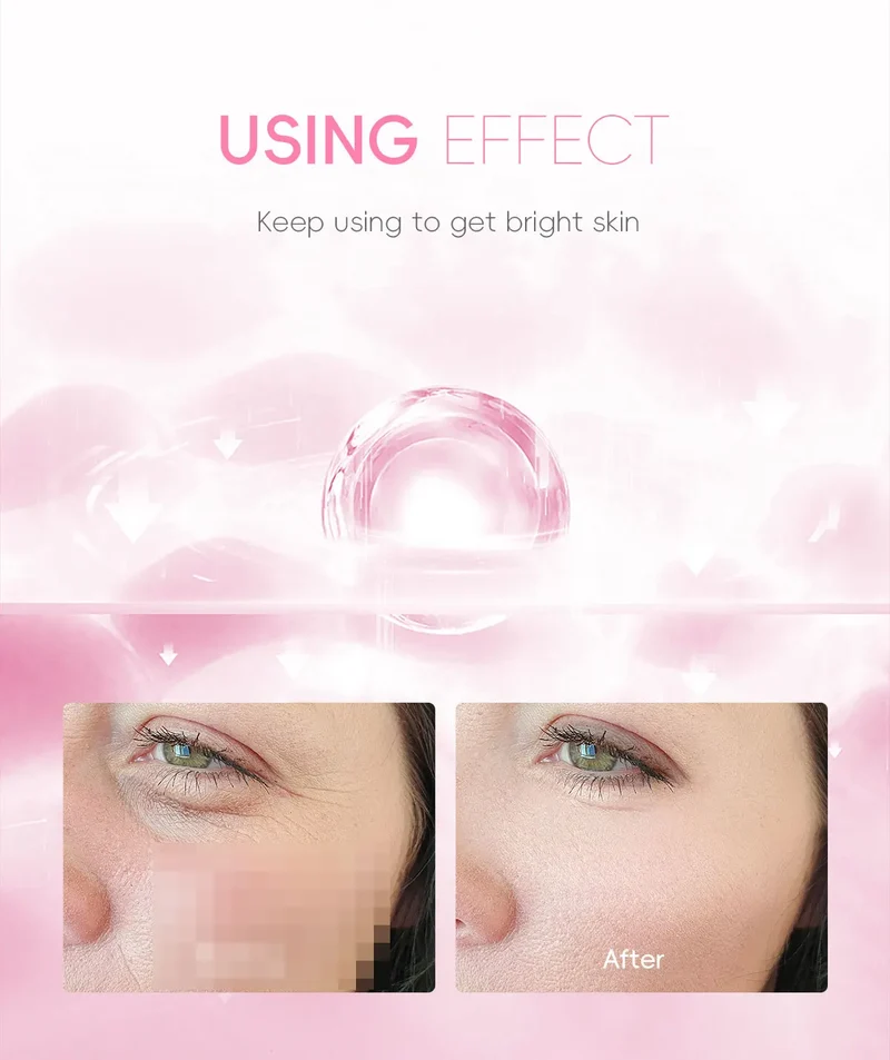 LAIKOU VITAMIN WHITENING CREAM Lightening Repairing Smooth Skincare Whitening Creams