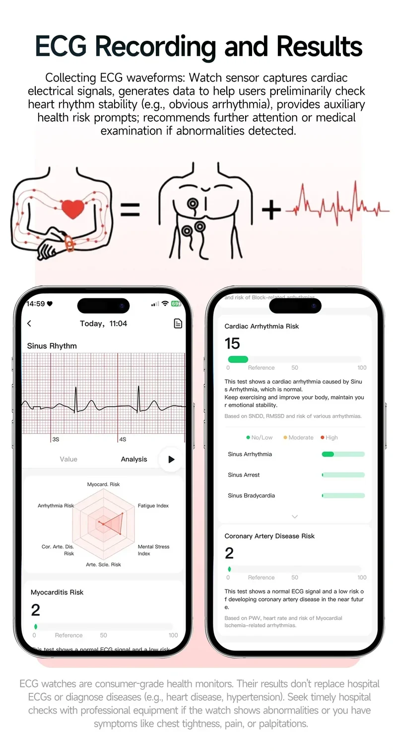 2026 New Health Smart Watch Precise Measurement ECG+PPG Blood Pressure Uric Acid Body Fat Analysis call SmartWatch For Men Women