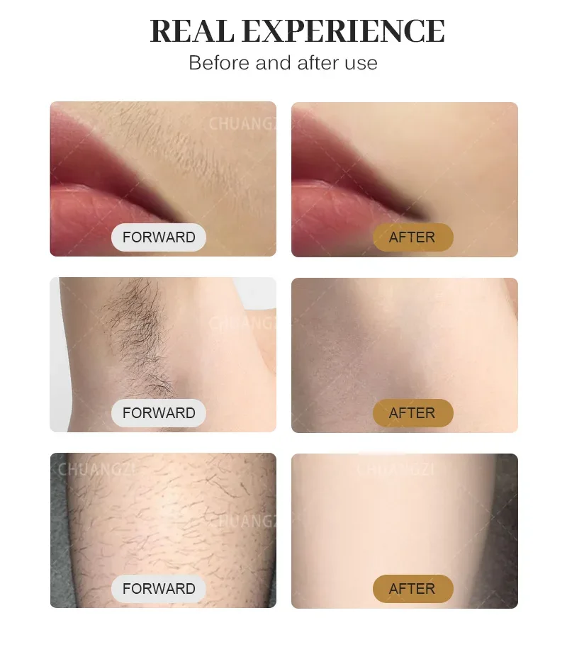 4000W Ice Point Painless 808nm laser Permanent Hair Removal Device 4 Wavelength Semiconductor Laser Full Body Custo