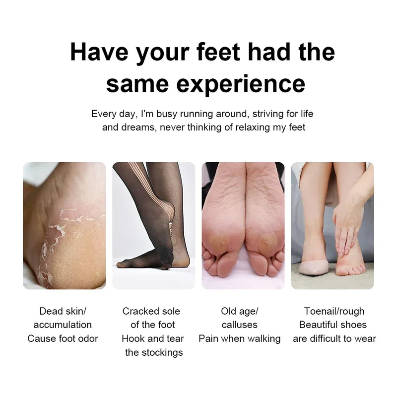 Electric Foot Callus Remover Rechargeable Electric Callus Remover Feet Care Electric Foot File for Feet