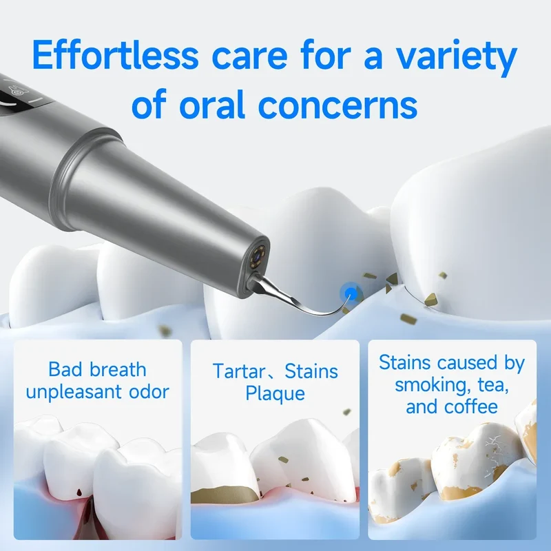 CURVY MOON Visible Electric Ultrasonic Tooth Cleaner with Camera Tartar Remover Tooth Stain Cleaning Tools Teeth Whitening Care