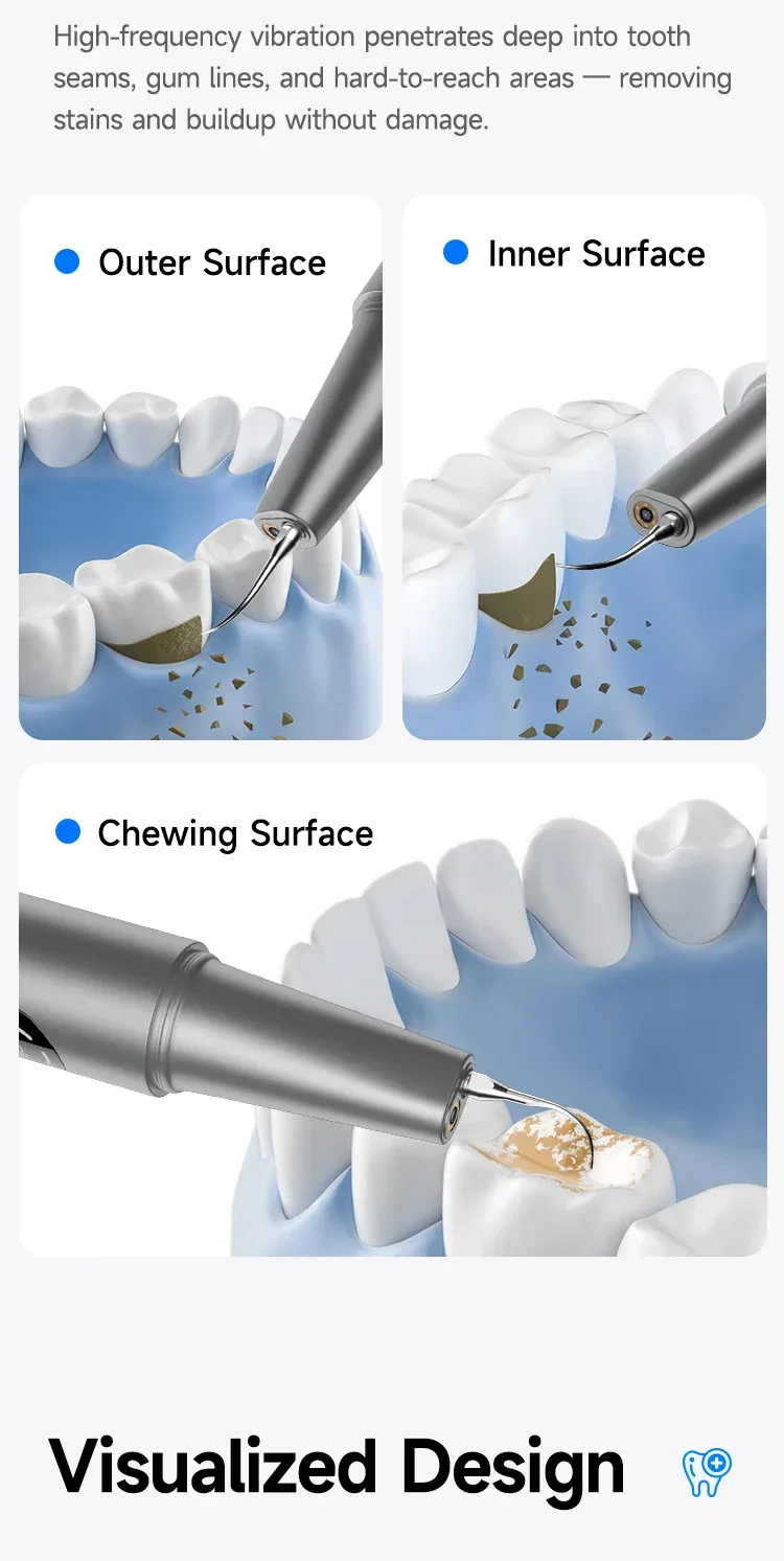 CURVY MOON Visible Electric Ultrasonic Tooth Cleaner with Camera Tartar Remover Tooth Stain Cleaning Tools Teeth Whitening Care