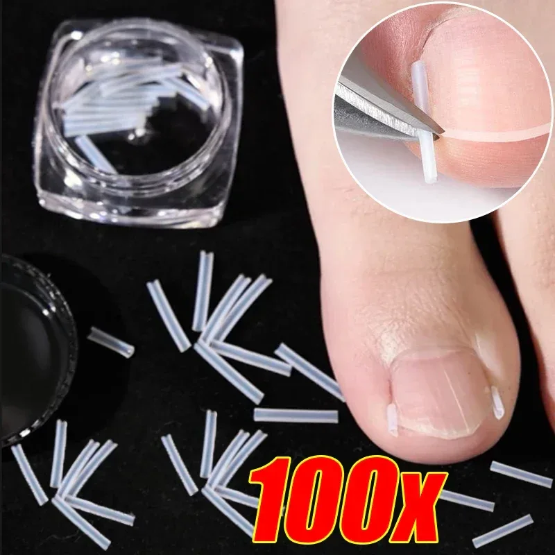 1-10 Box Elastic C-shaped Tube Padding Treatment Foot Care Invisible Groove Straightening Clip Ingrown Toenail Corrector Tools