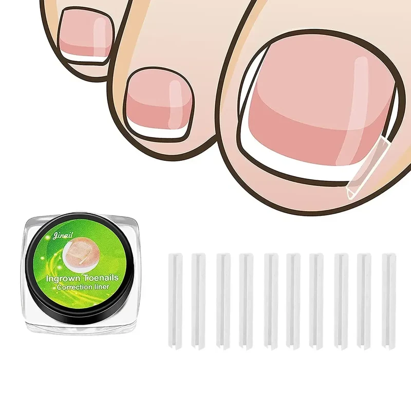 1-10 Box Elastic C-shaped Tube Padding Treatment Foot Care Invisible Groove Straightening Clip Ingrown Toenail Corrector Tools