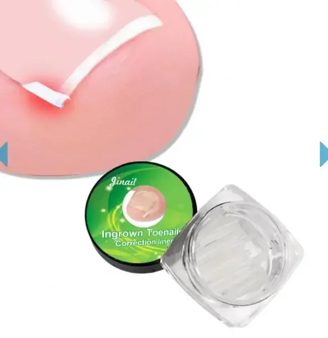 1-10 Box Elastic C-shaped Tube Padding Treatment Foot Care Invisible Groove Straightening Clip Ingrown Toenail Corrector Tools