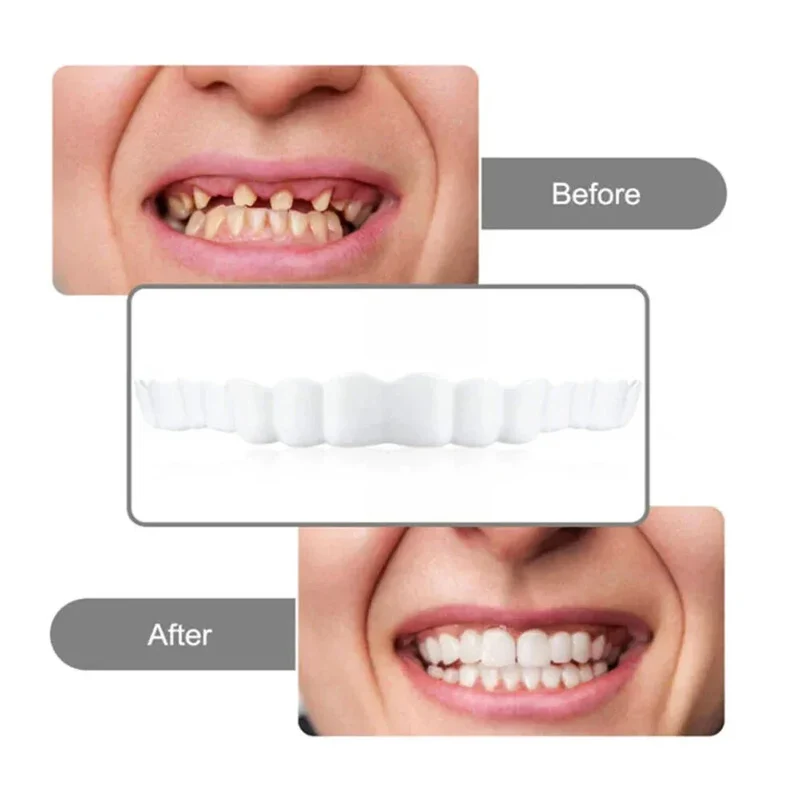 2 Pairs Smile Whitening Teeth Snap On Silicone Cosmetic Denture Upper and Lower Fake Tooth Cover Perfect Fit Teeth Beauty Tool