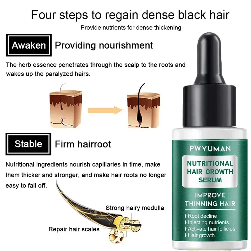 7 Days Ginger Hair Growth Serum Fast Promote Hair Regrowth Products Anti Hair Loss Repair Scalp Baldness Nourish Hair Root Care