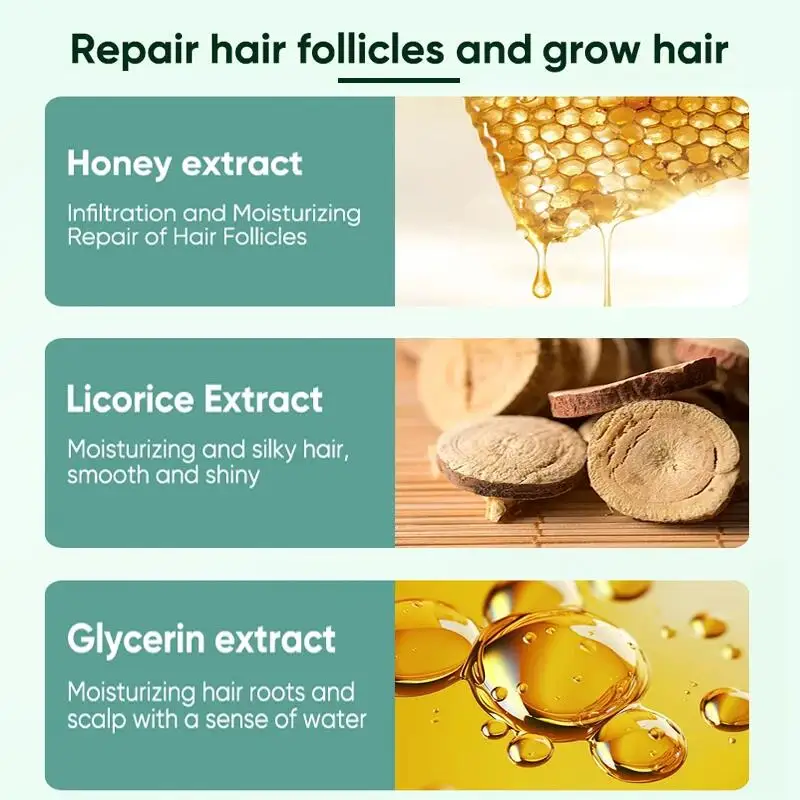7 Days Ginger Hair Growth Serum Fast Promote Hair Regrowth Products Anti Hair Loss Repair Scalp Baldness Nourish Hair Root Care
