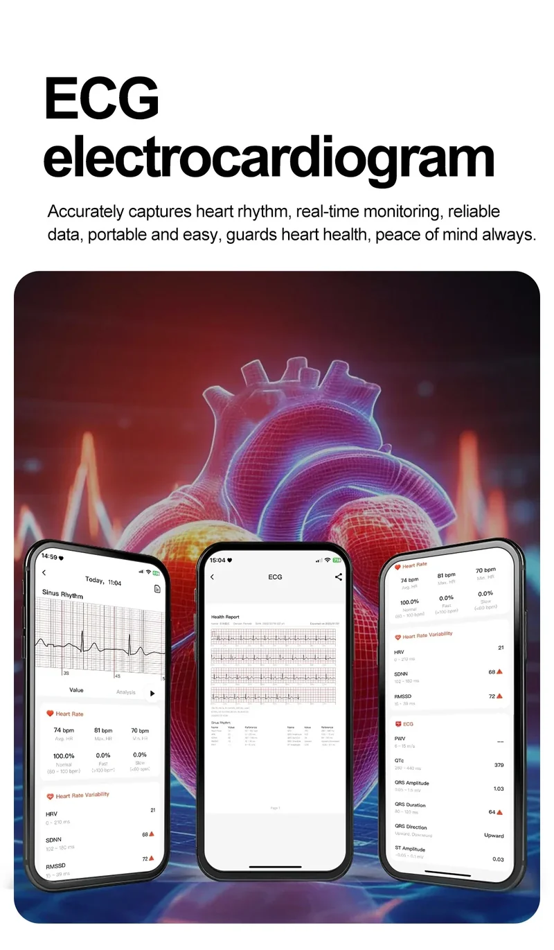 New Uric Acid Blood Lipids AI-GPT ECG Smartwatch Micro Physical Examination Body Analysis Men BT Call LED Flashlight Smartwatch
