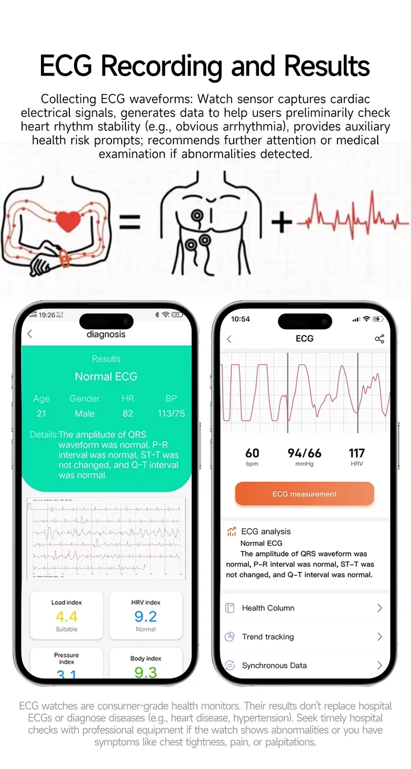 New 650nm Dual probe laser Health Smart Watch ECG+PPG Blood pressure Uric Acid Blood lipids AMOLED Physical therapy Smartwatches
